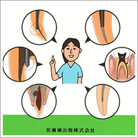 ピックアップ（１）